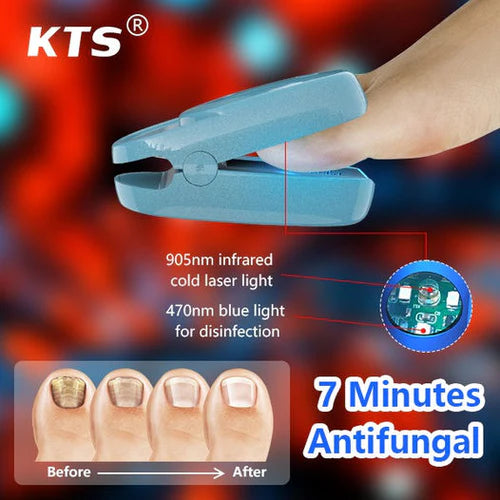 KTS New Onychomycosis Laser Treatment Device