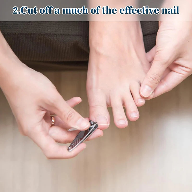 KTS Nail Fungus Laser Treatment Device