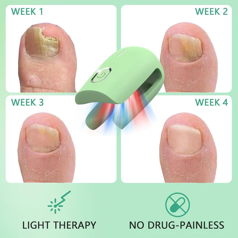 KTS Nail Fungus Cleaning Device for Onychomycosis