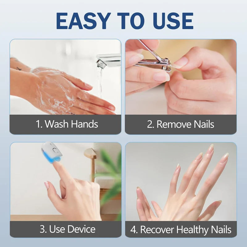 KTS Nail Fungus Laser Therapy Device