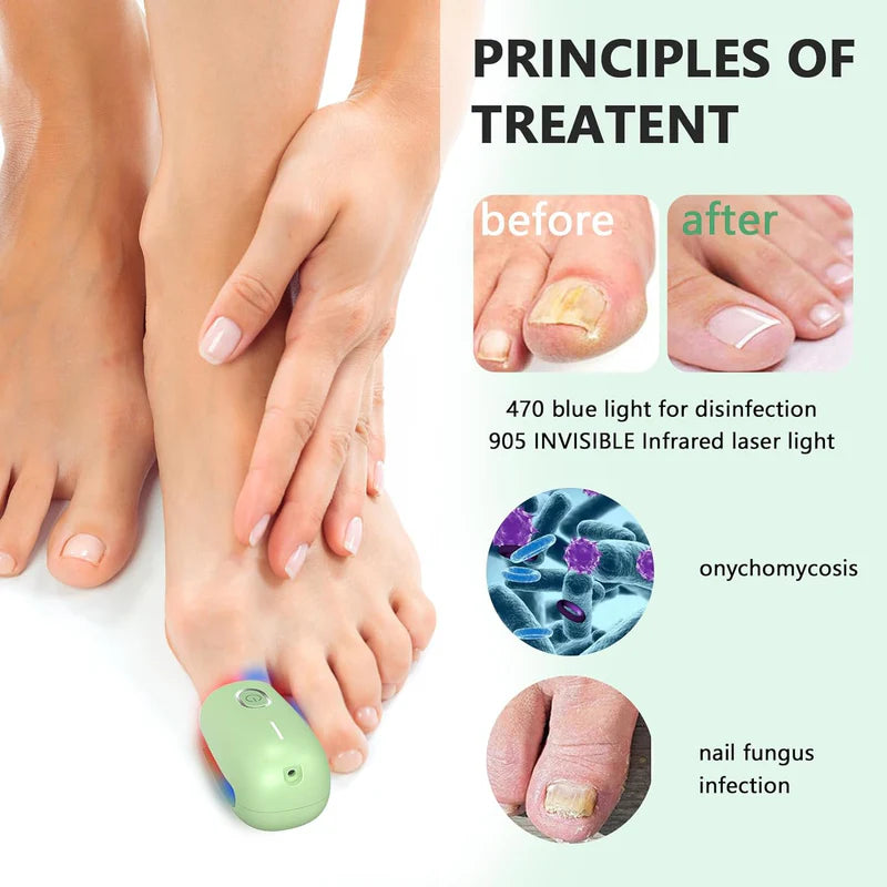 KTS Nail Fungus Cleaning Device for Onychomycosis