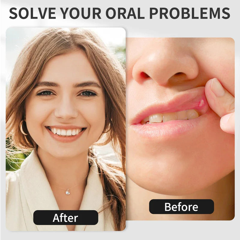 KTS Red Light Oral Therapy Device