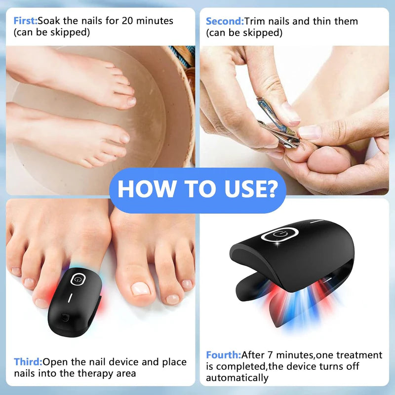 KTS Nail Fungus Cleaning Device for Onychomycosis