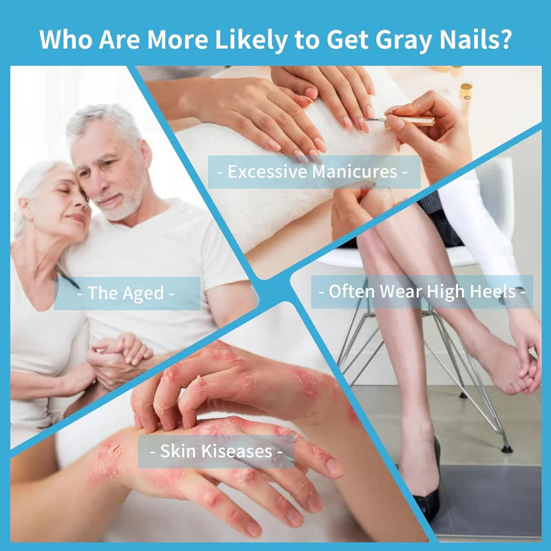 KTS Nail Fungus Laser Treatment Device