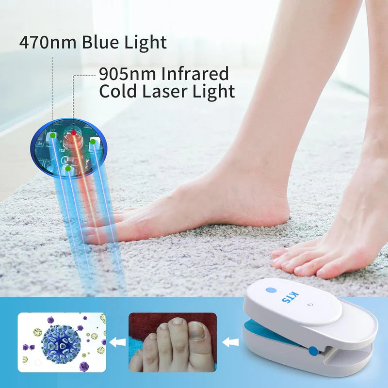 KTS Nail Fungus Laser Treatment Device