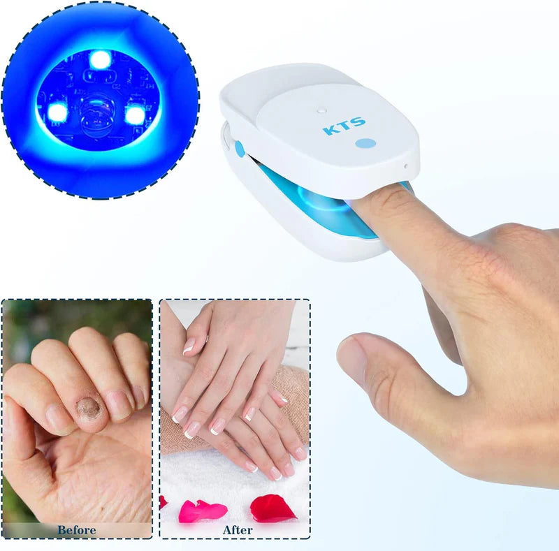 KTS Nail Fungus Cleaning Device - Onychomycosis