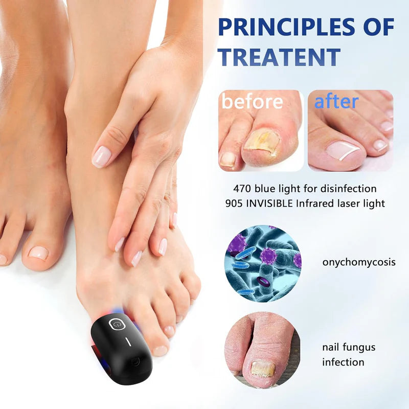 KTS Nail Fungus Cleaning Device for Onychomycosis
