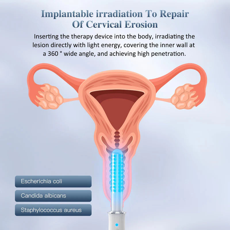 KTS Portable Vaginal Rejuvenation Wand