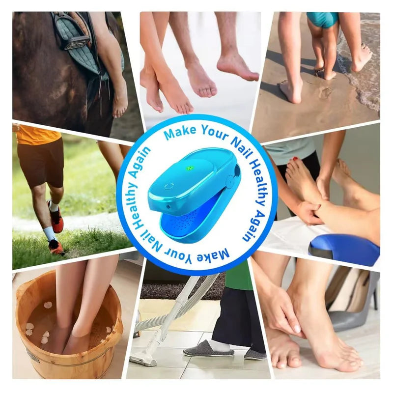KTS New Onychomycosis Laser Treatment Device