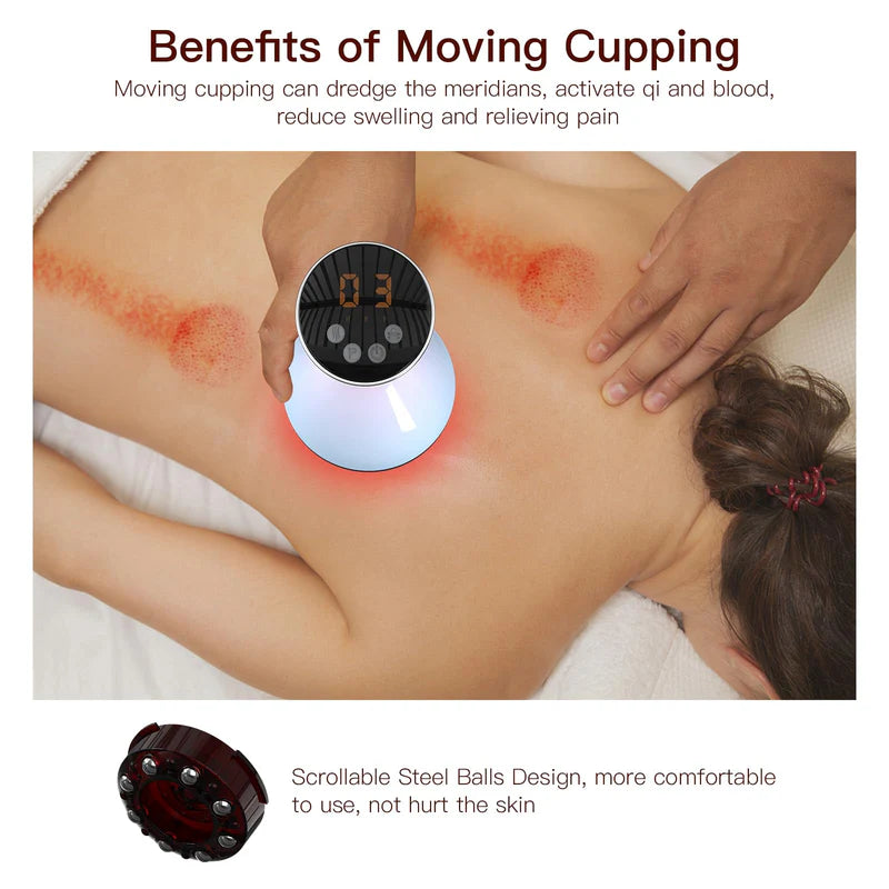KTS Electric Cupping Treatment
