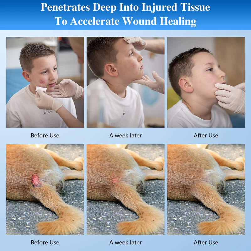 KTS Red Light Therapy Flashlight for Face