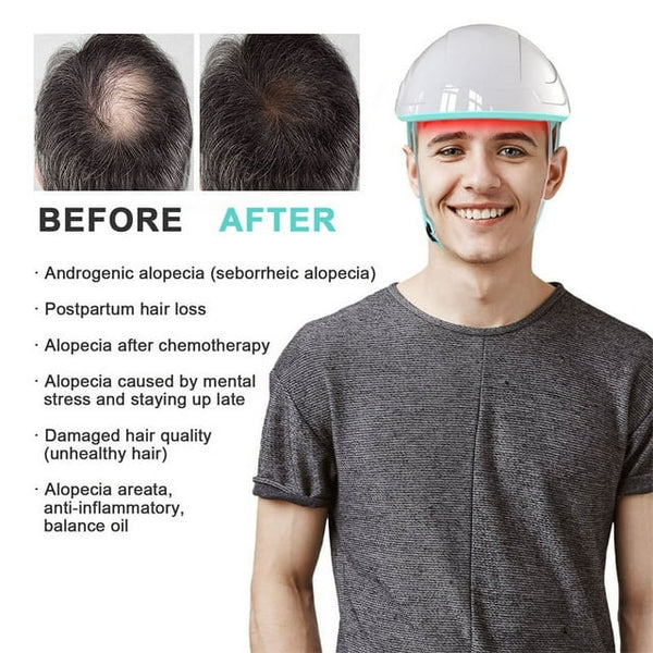 KTS Hair Regrowth Treatments Laser Cap