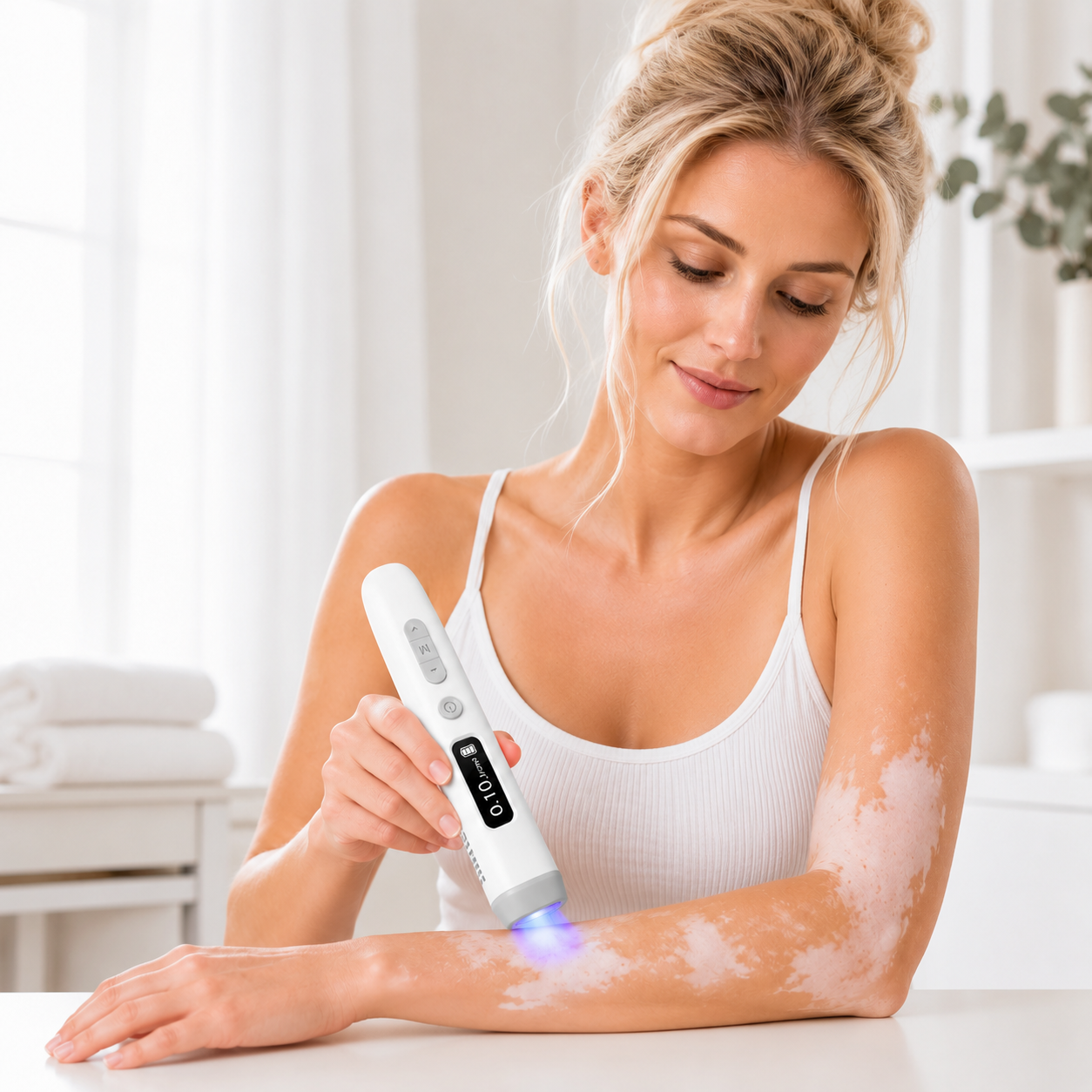 2026 New KTS Handheld 308nm UVB Light Phototherapy Device