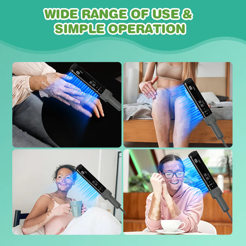 Philips Narrowband UVB Vitiligo/Psoriasis Light Therapy Device