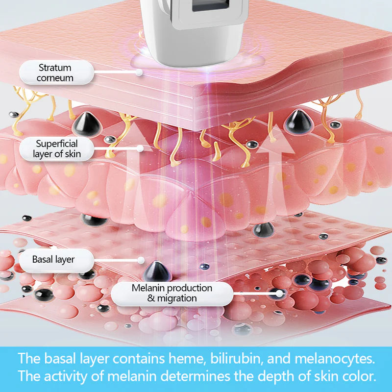 UVB Vitiligo/Psoriasis Light Therapy Device for Home