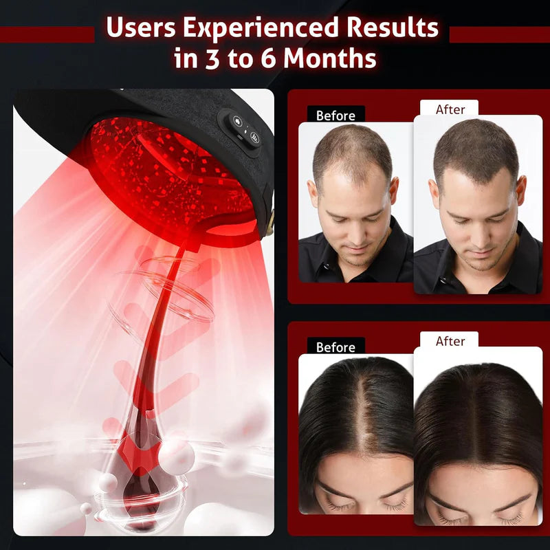 KTS® Wireless Laser Cap for Hair Growth