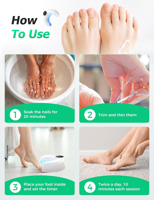 Wireless Nail Fungus Laser Treatment Devices for Multiple Toenails