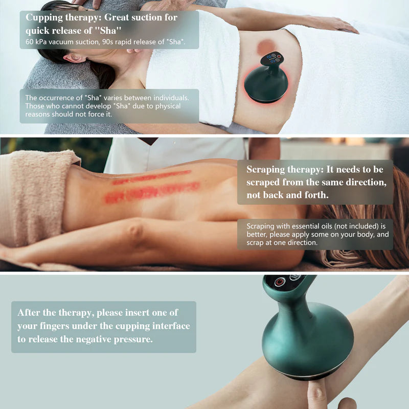 KTS 3-in-1 Cupping Treatment Kit