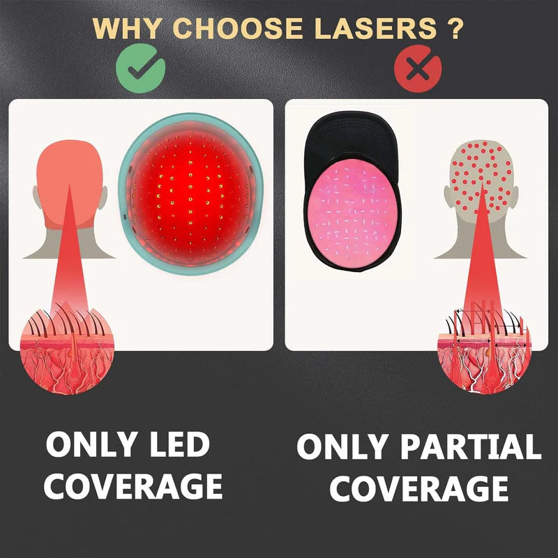 KTS Hair Regrowth Treatments Laser Cap