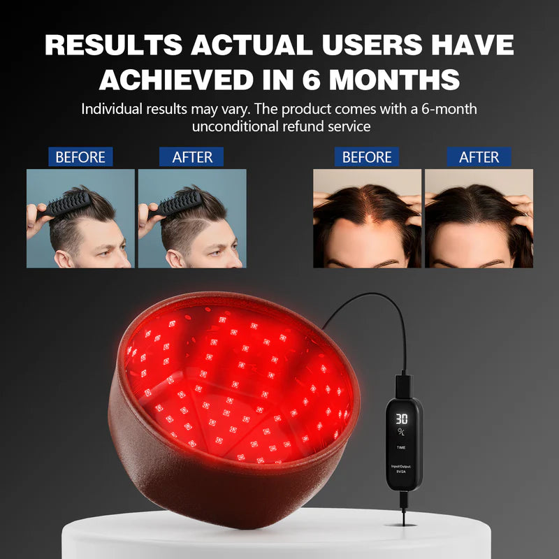 KTS Laser Hair Regrowth Cap 1.0 Pro