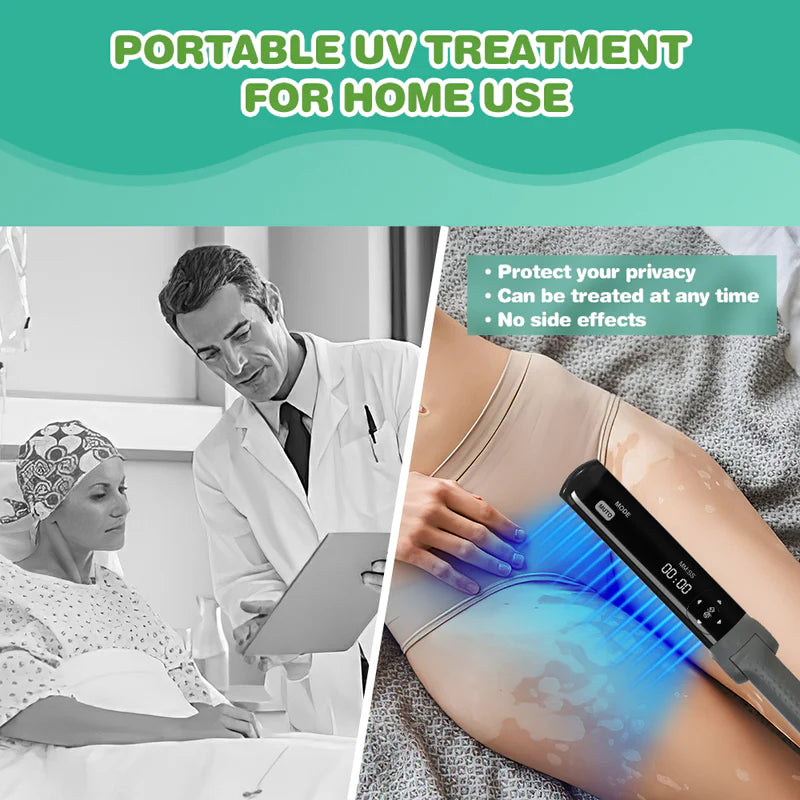 Philips Narrowband UVB Vitiligo/Psoriasis Light Therapy Device